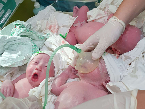 Ca sinh ba hiện nay không hiếm!